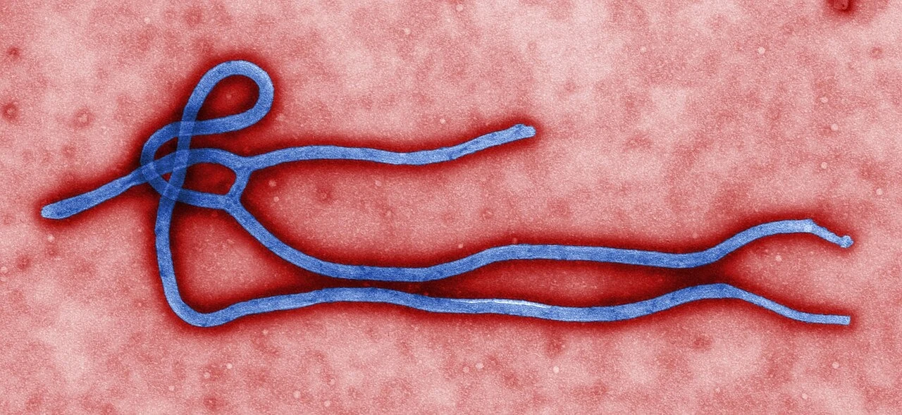 Nigeria : un cas d'Ebola confirmé à Abuja, 44 contacts identifiés